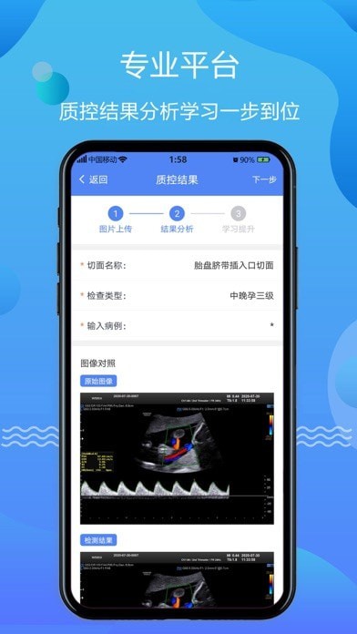 超声智库